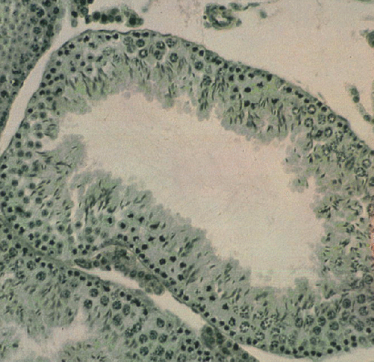 s257 testis micrograph