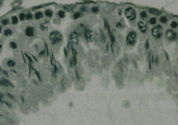 s259 testis HP micrograph