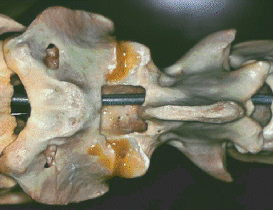 cow thoracic vertebrae